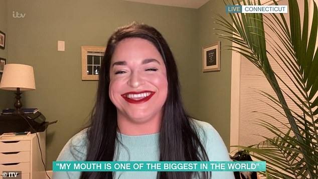 Dünyanın en büyük ağızlı kadınlarından biri TikTok fenomeni - Resim : 1